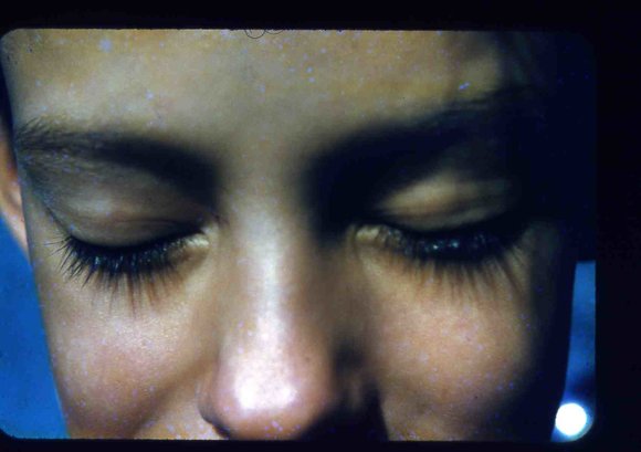 036  greg  eyelashes hicksville 1954036