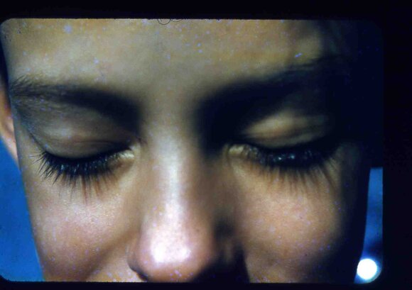 036  greg  eyelashes hicksville 1954036